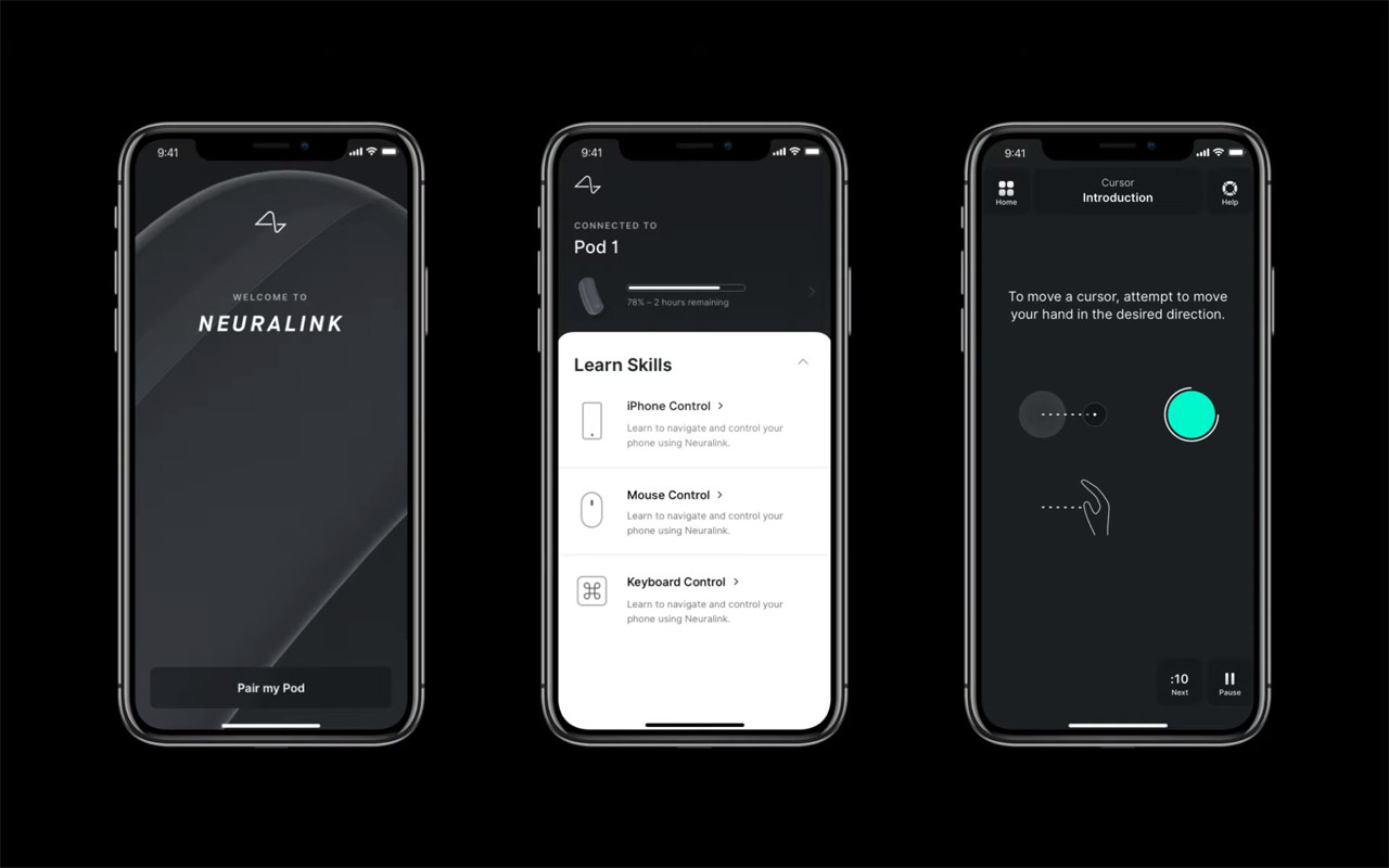 Neuralinkが開発したスマートフォン用アプリ